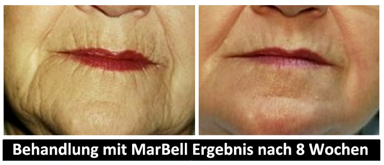 MarBell