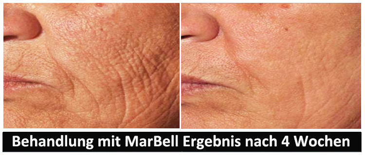 MarBell