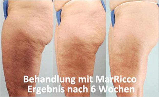 MarRicco