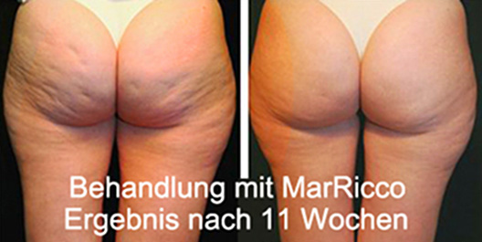 MarRicco