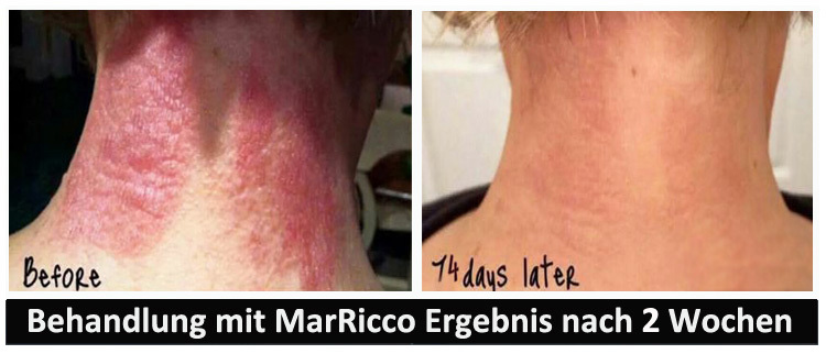 MarRicco