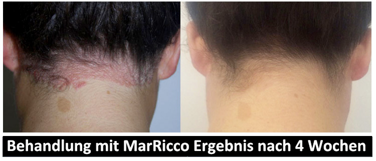 MarRicco