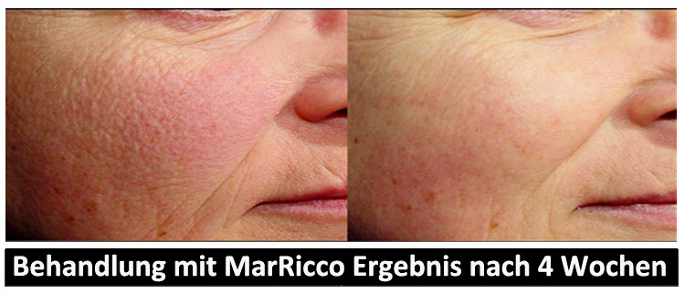 MarRicco