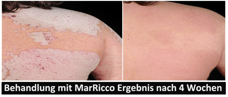 MarRicco