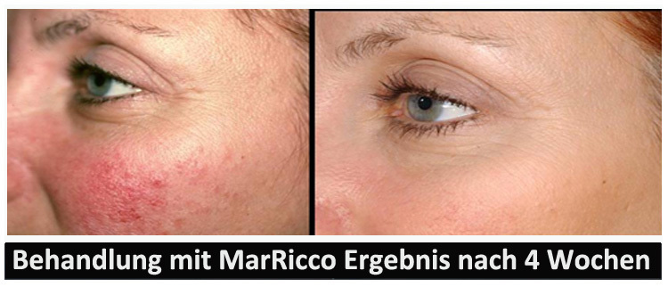 MarRicco