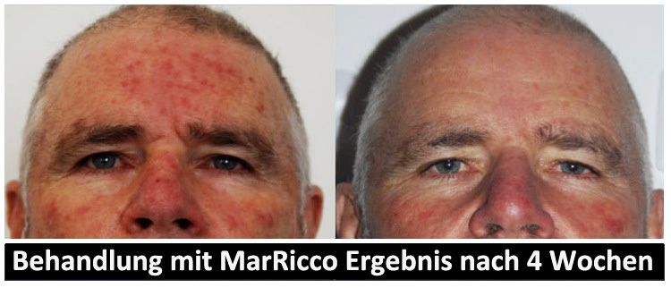 MarRicco