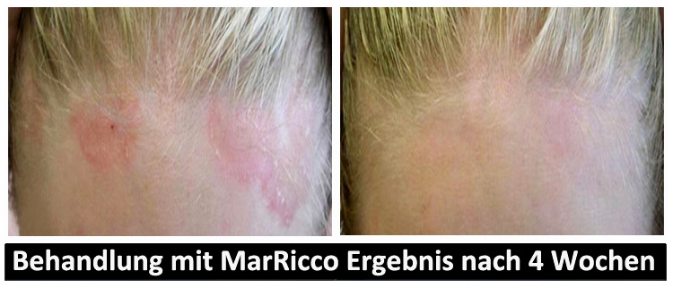 MarRicco