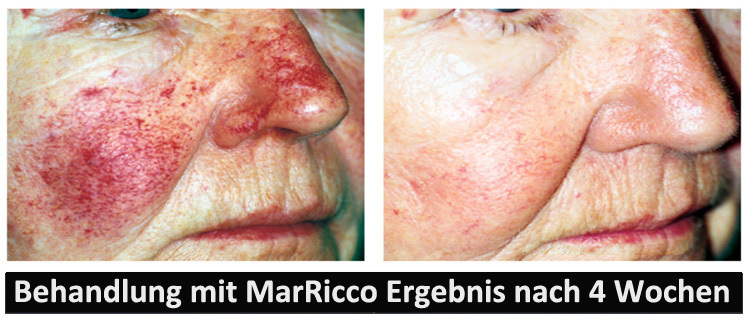 MarRicco