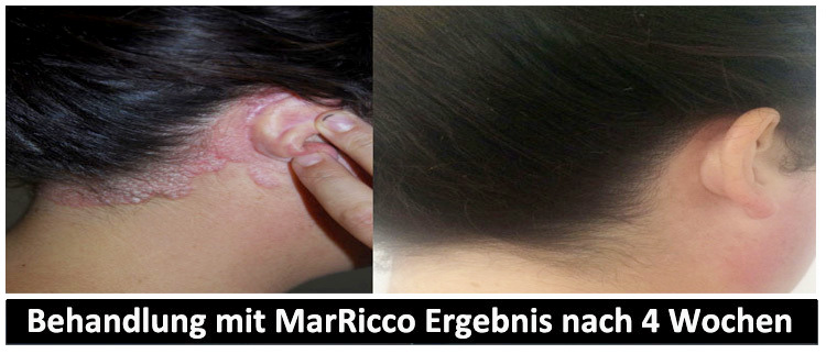 MarRicco