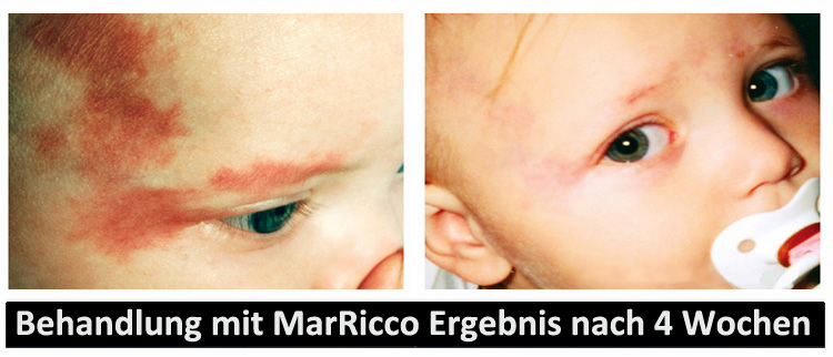 MarRicco